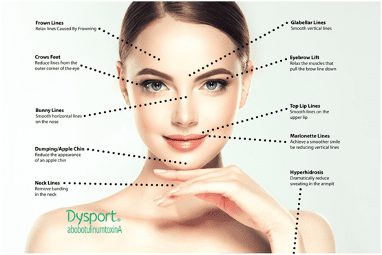 Dysport Treatment for Lines Between the Brows