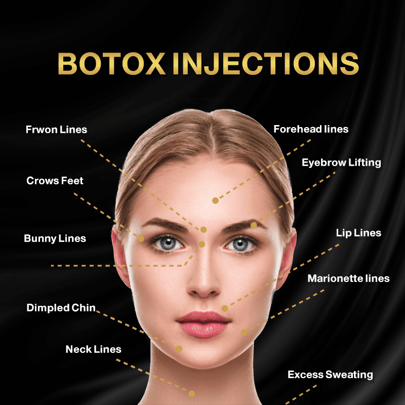 How Long Does Botox Last?